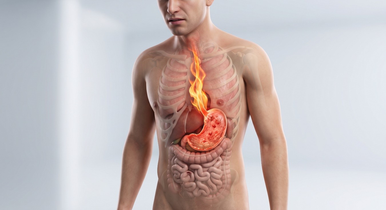 Gastritis